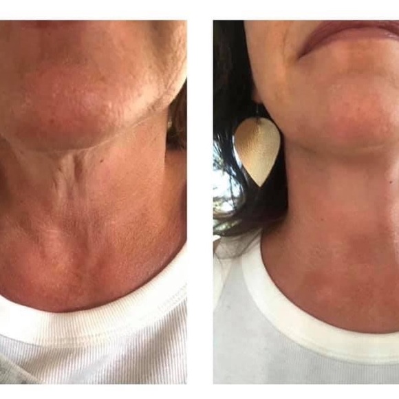 NUSKIN AGELOC HONEY & HIBISCUS CELLULITE LOTION 💋 Lot of 2 tubes - Picture 3 of 7